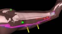 Microsoft holomens的混合现实技术可帮助外科医生 “透视” 身体