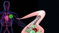 磁化导线可以及早发现癌症